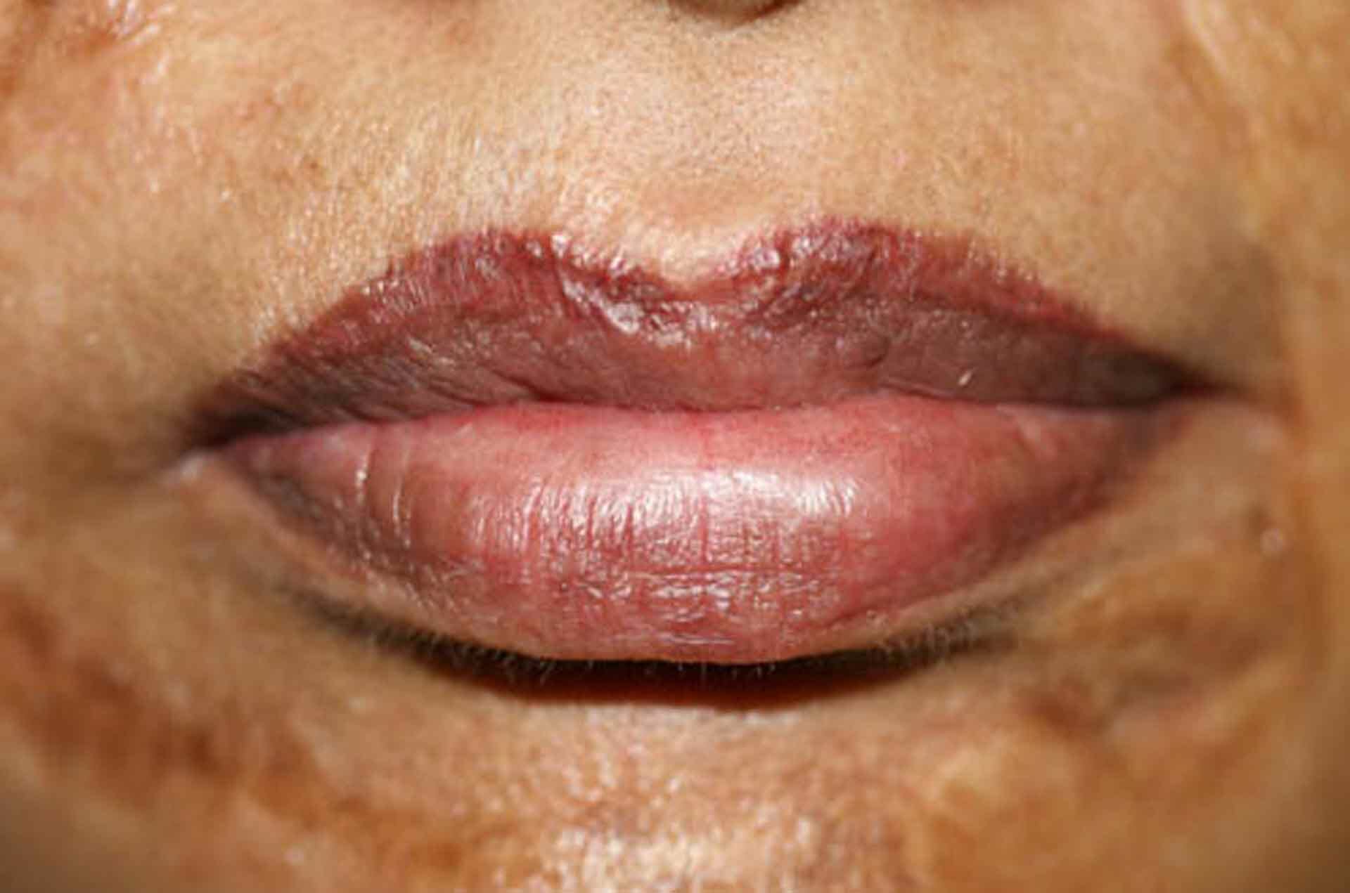 after_3 permanent lipstick tattoo by ruth swissa med spa