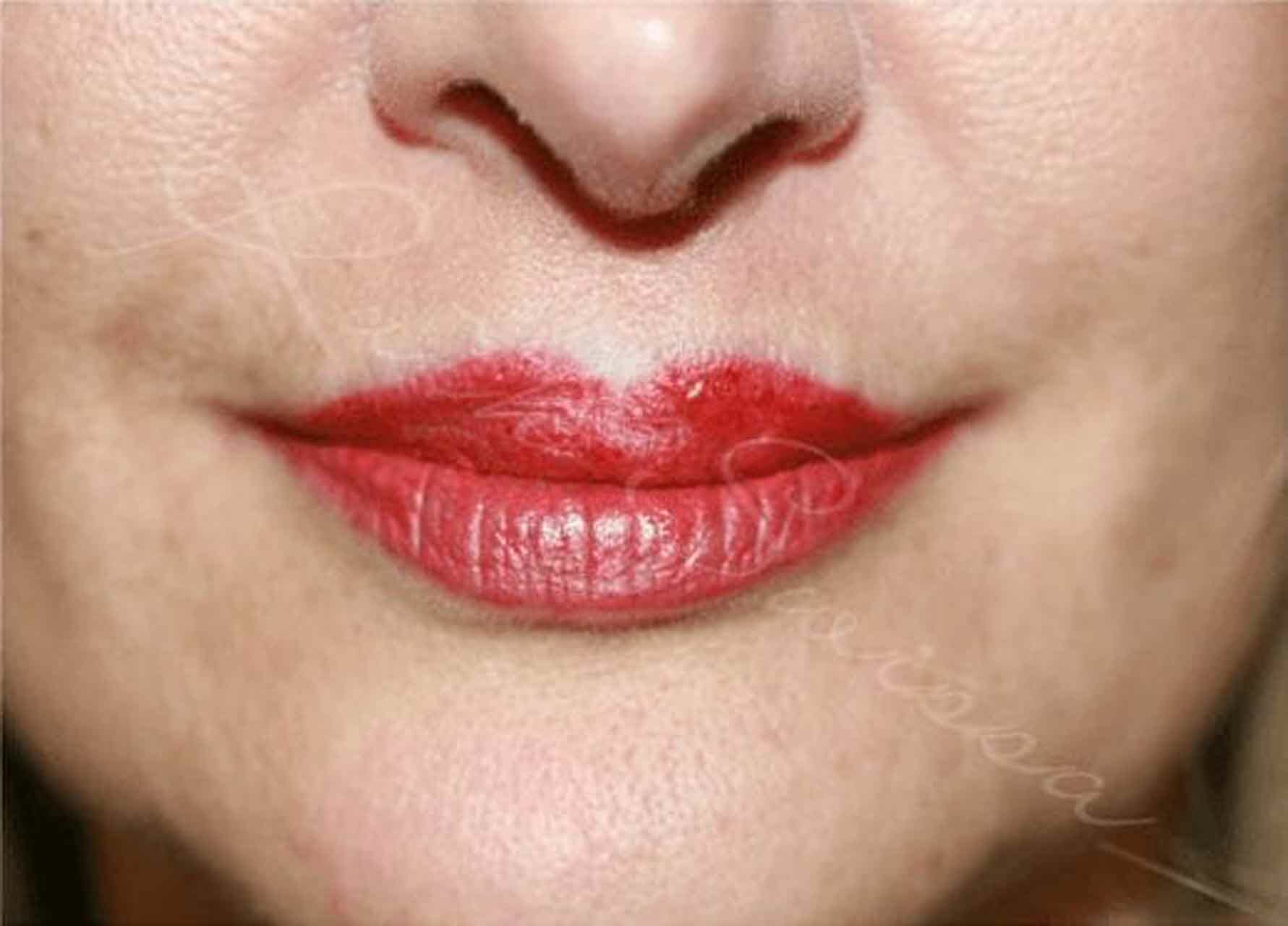 permanent lipstick tattoo by ruth swissa medical spa