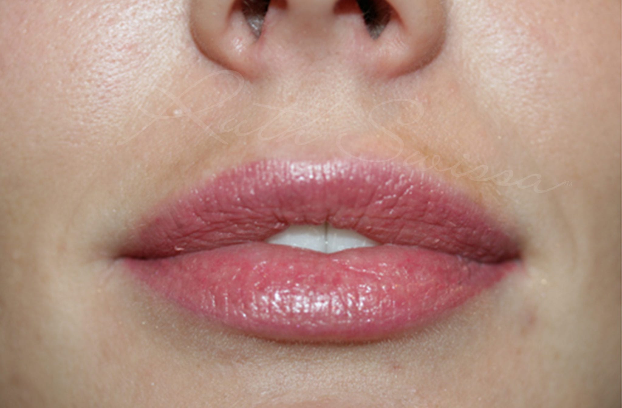 permanent lipstick before and after by ruth swissa med spa