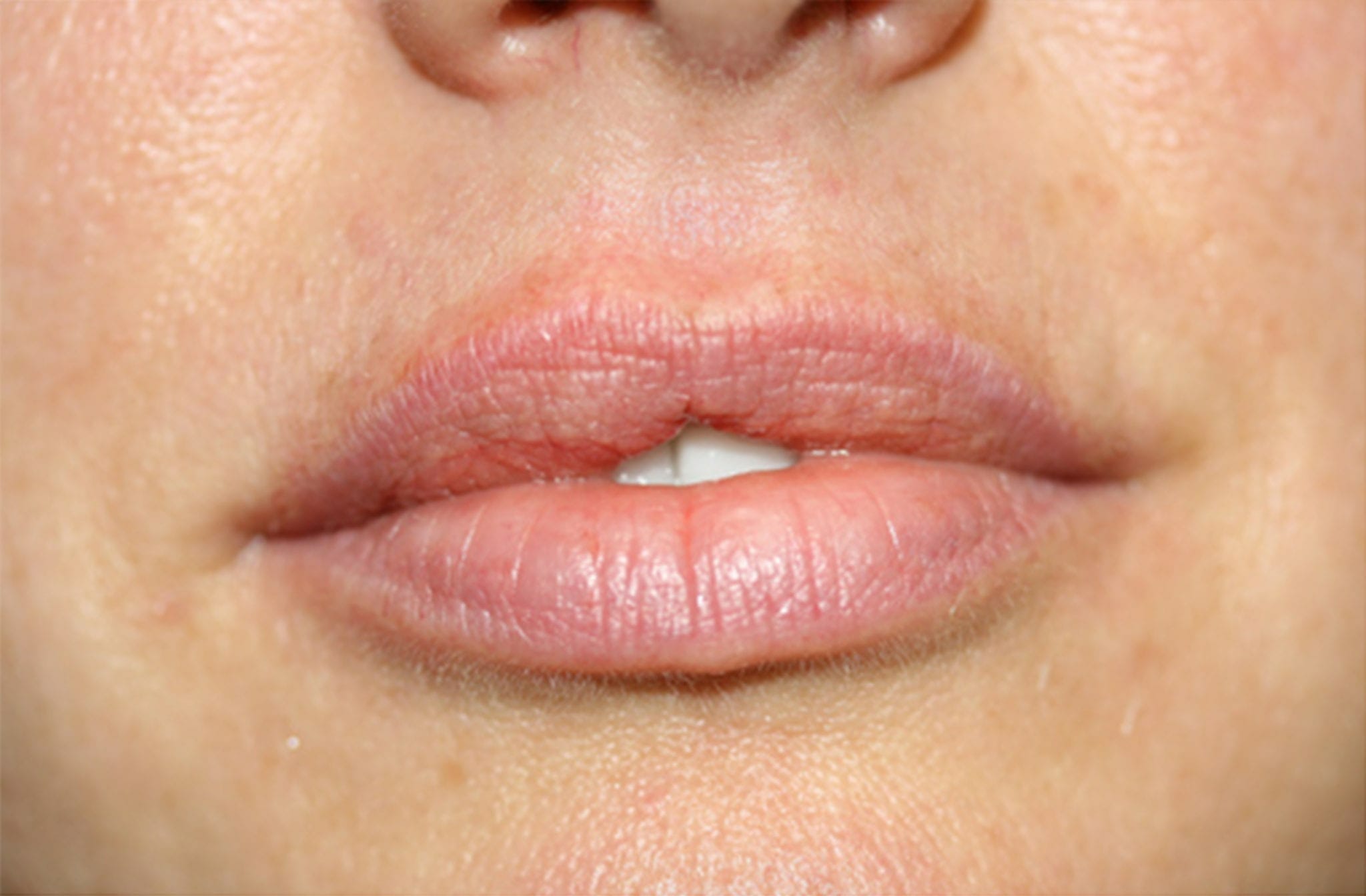 permanent lipstick before and after by ruth swissa