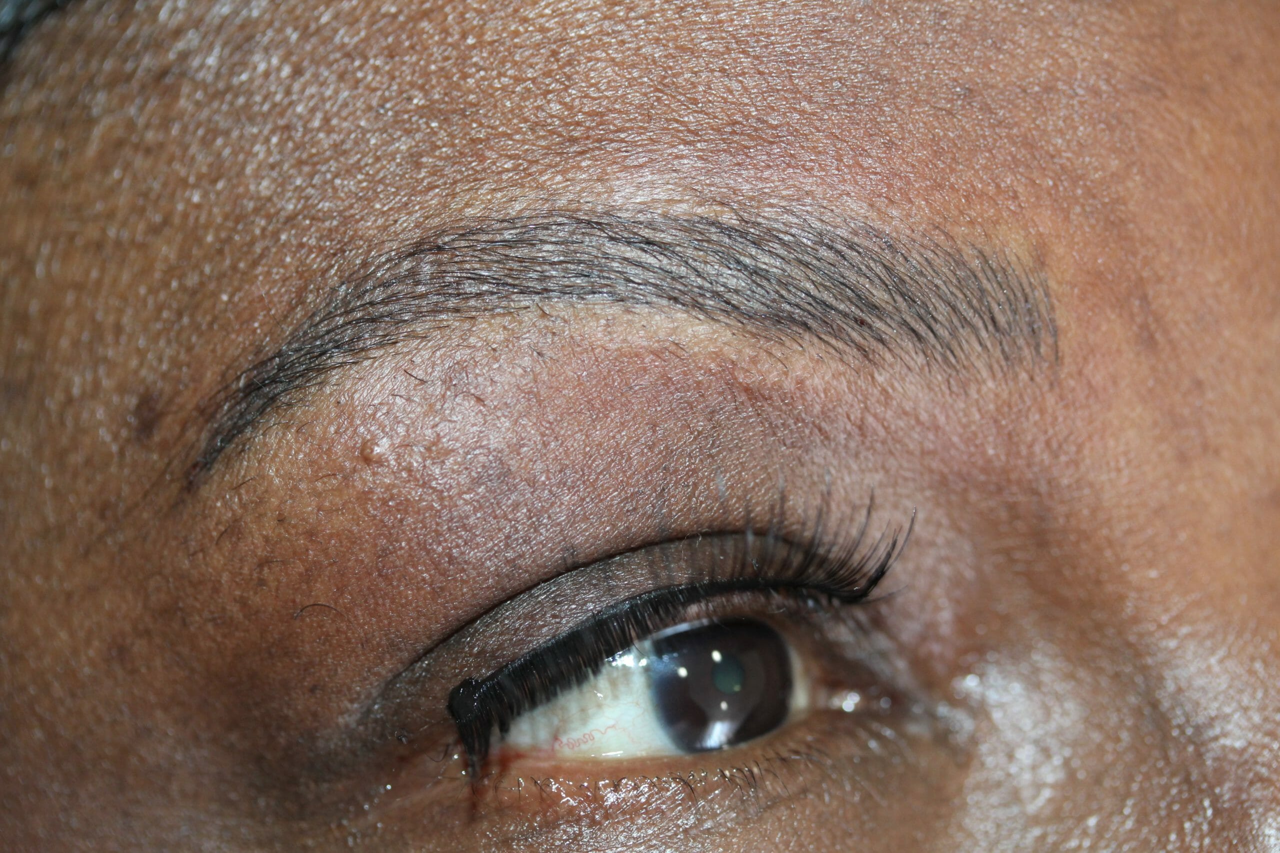 permanent eyebrow tattoo at ruth swissa medical spa