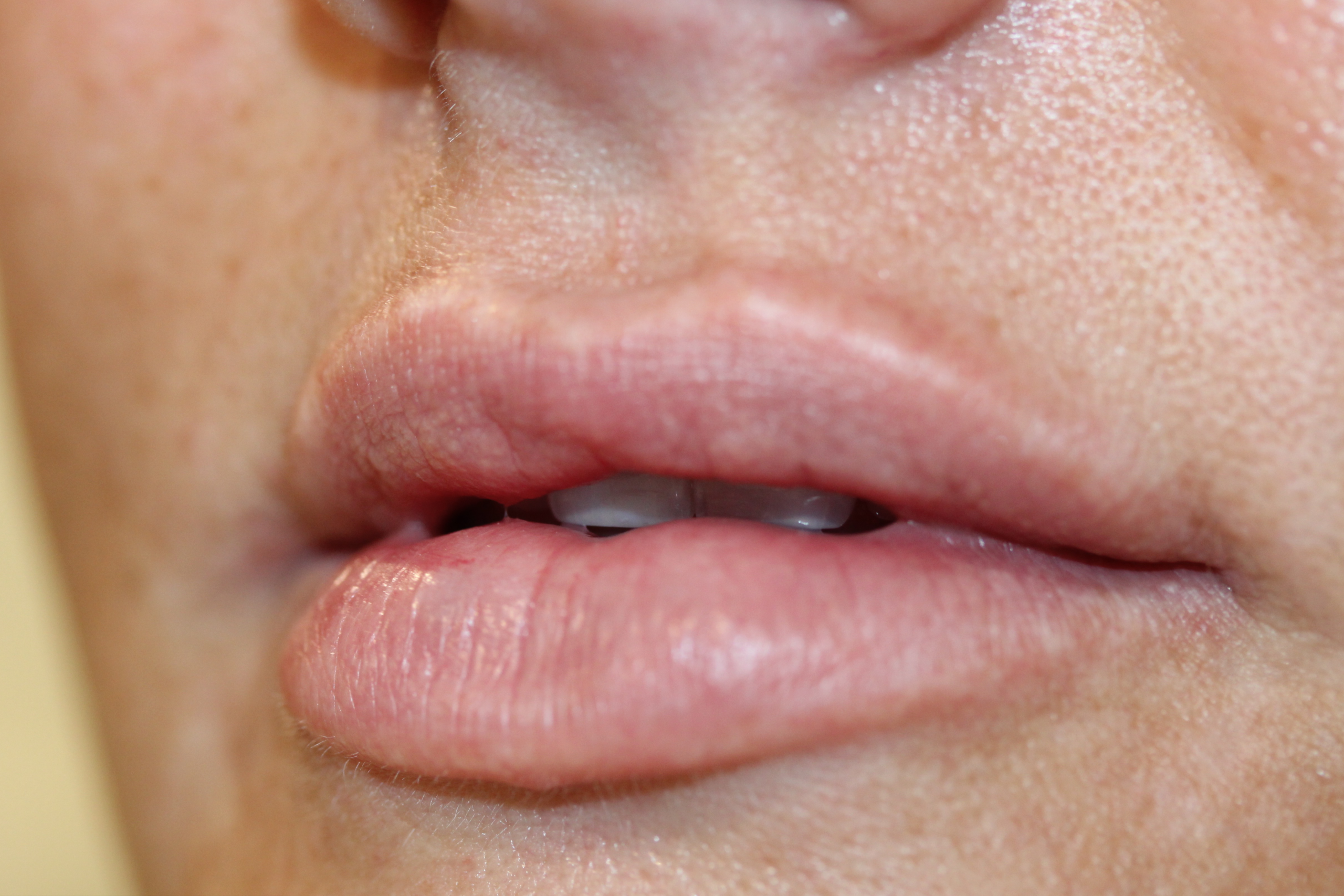 permanent lips at ruth swissa
