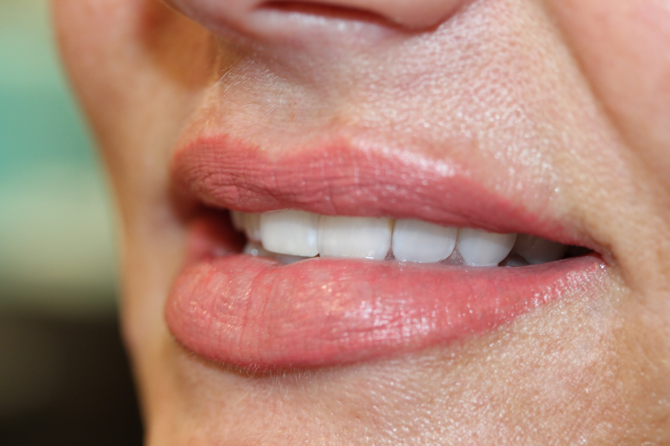 ruth swissa med spa permanent lips 