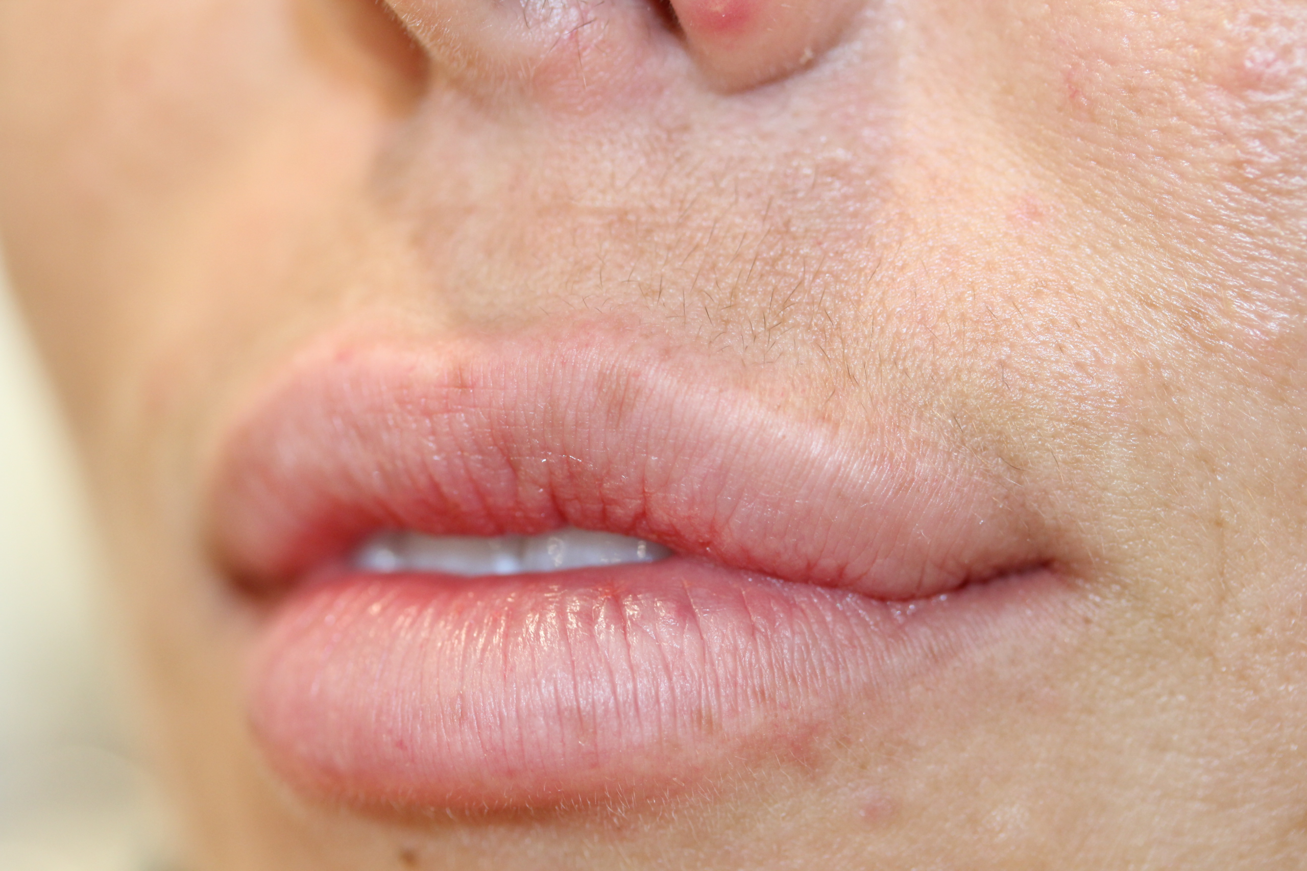 ruth swissa permanent lips med spa