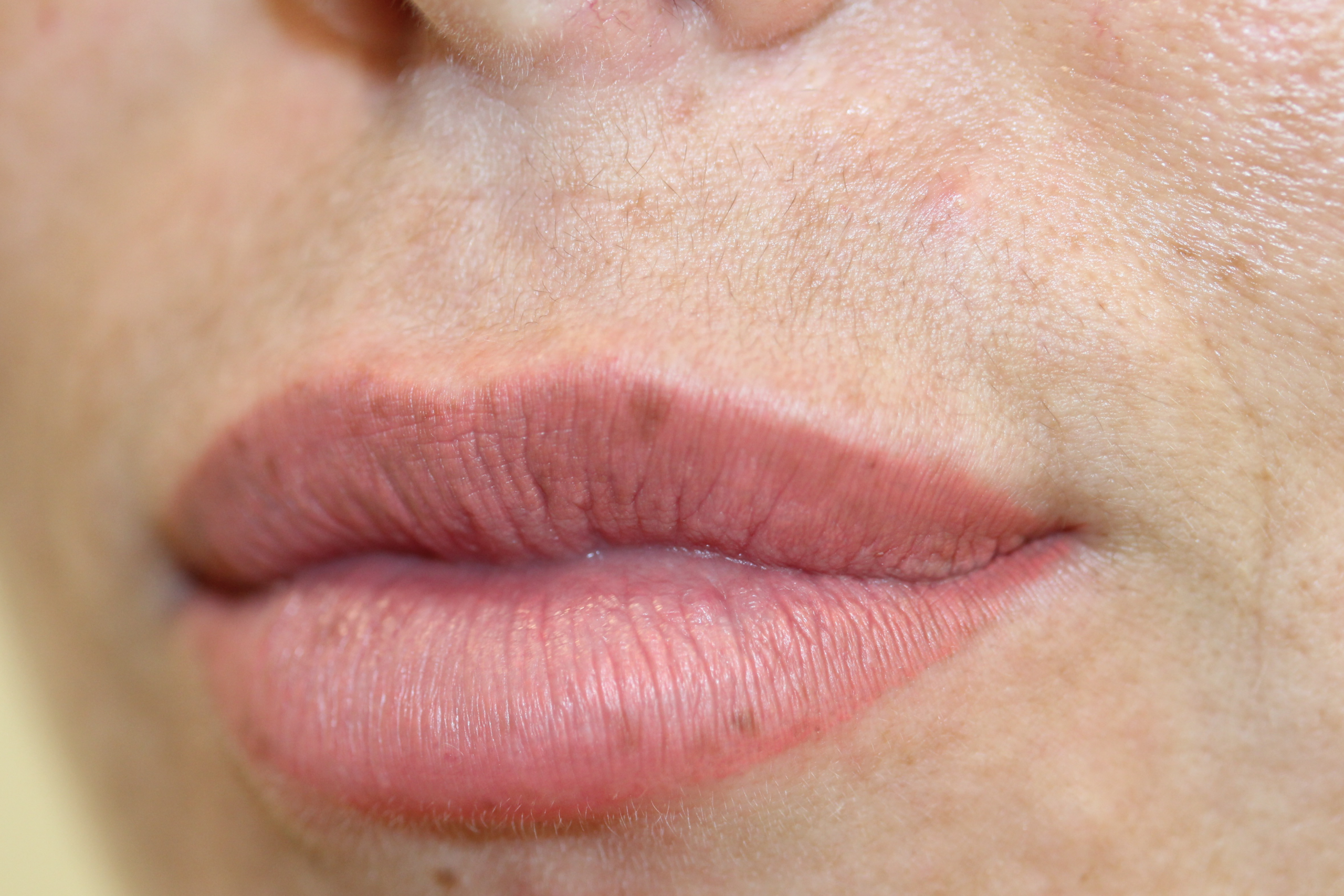 ruth swissa permanent lips in medical spa