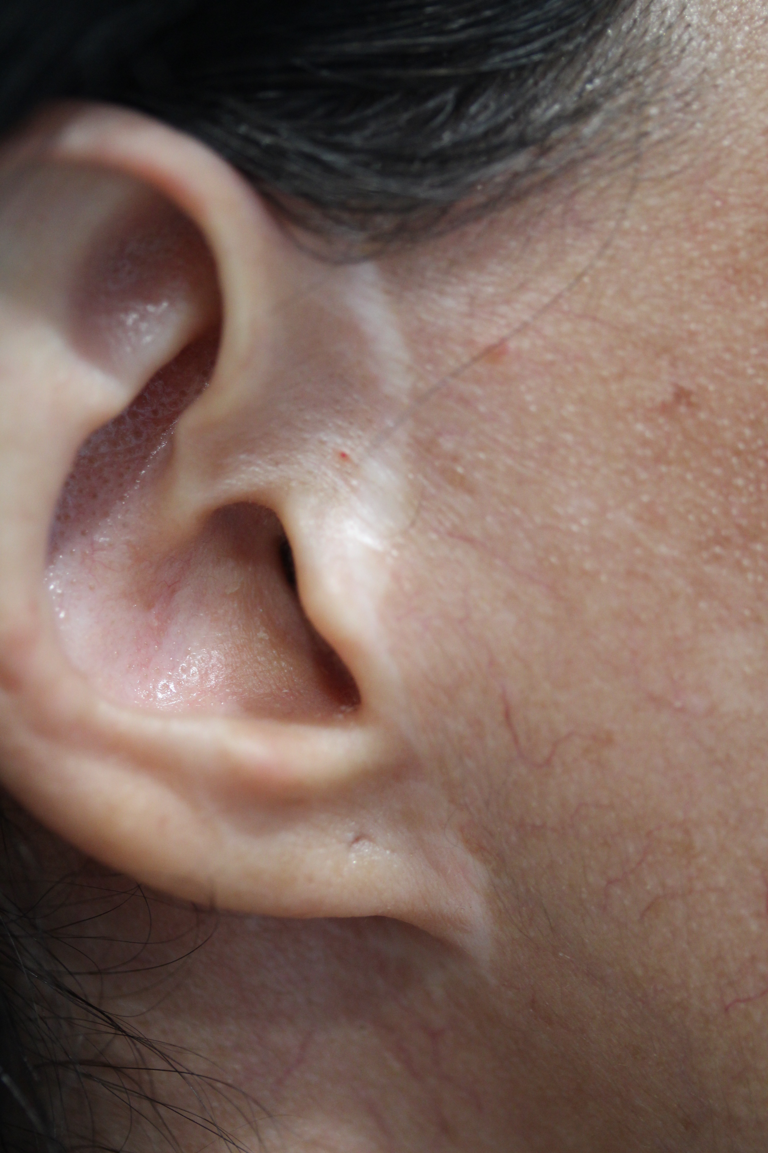 Ruth Swissa Scar Camouflage Permanent Makeup