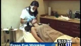 Eye Microdermabrasion To Look Younger Fox 11 Reports