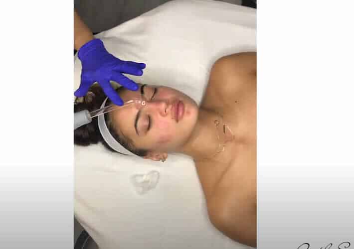Deep Cleaning Facial Pore-Extraction Youtube Video