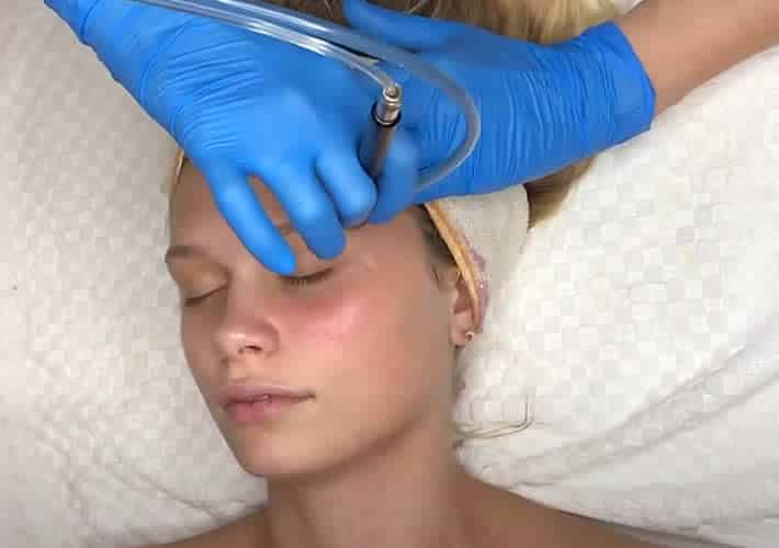 08 Dermalinfusion Hydrafacial With Delilah Summer