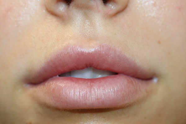 Permanent Lip Liner before