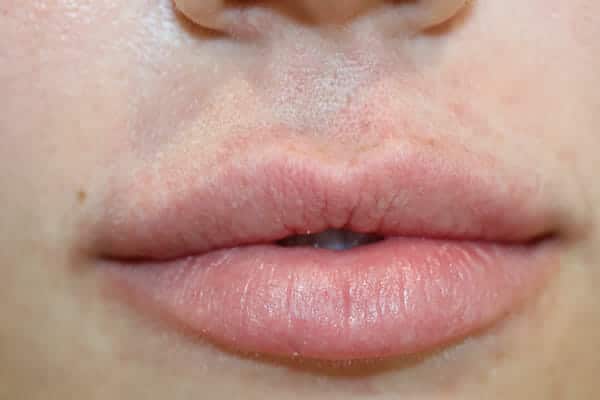 Permanent Lip Liner before