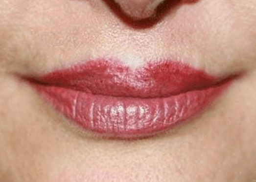 Ruth Swissa Permanent Lip Blush Cleft lip