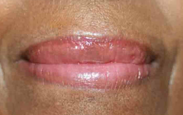 ruth swissa medical spa permanent lipstick tattoo