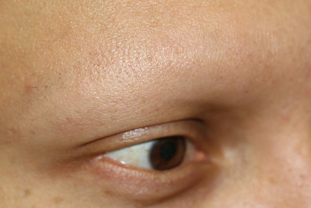 alopeica microblading permanent eyebrows ruth swissa