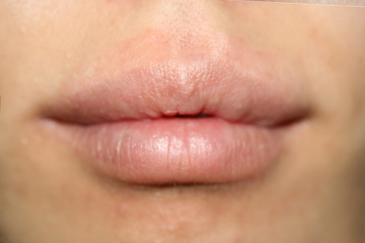lip blushing permanent lip liner Ruth Swissa lip blush